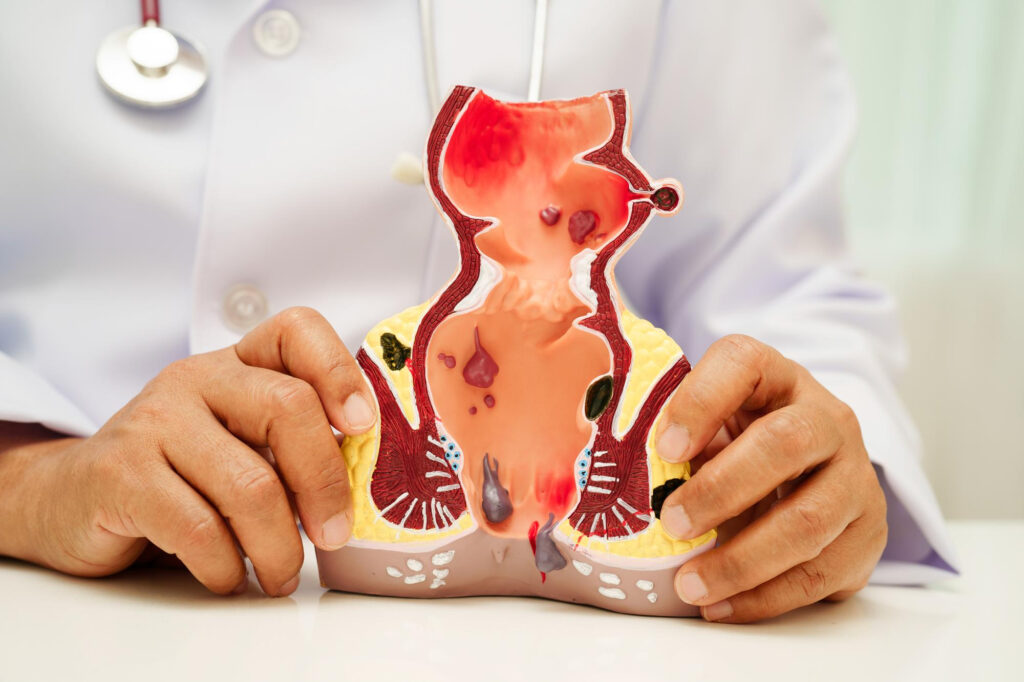 Différences entre marisque et cancer