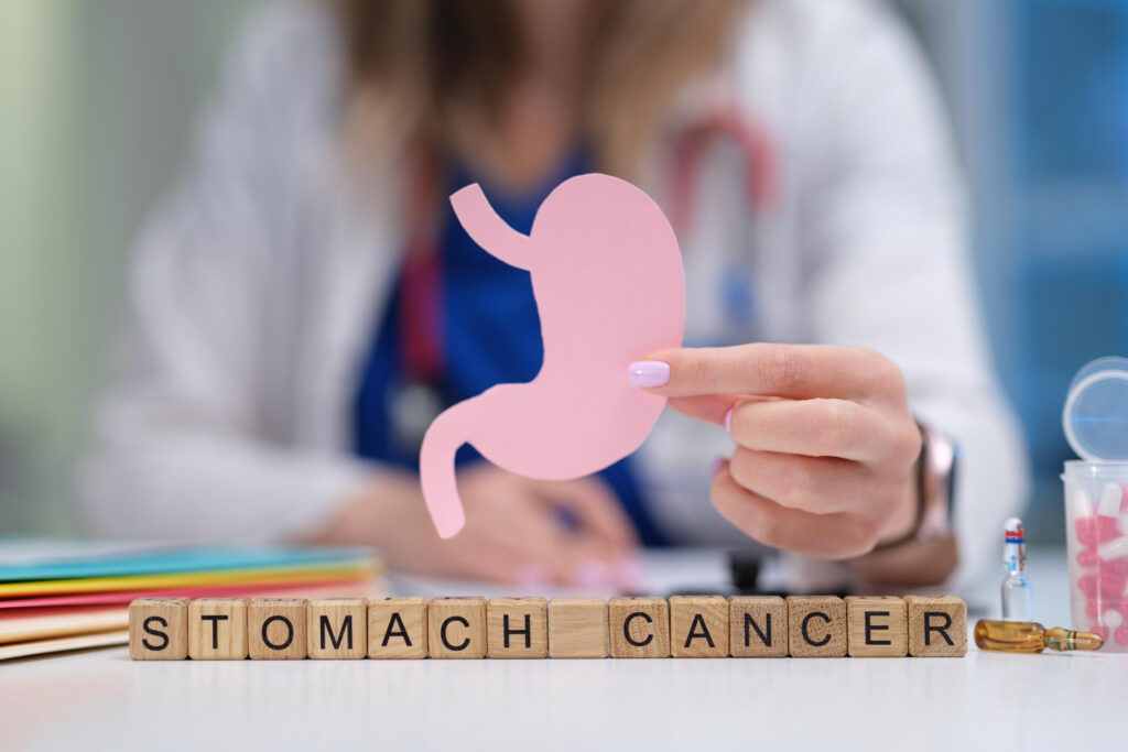 Cancer de l'estomac