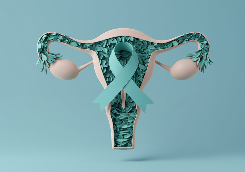 J’ai guéri cancer ovaire : ce que cela signifie vraiment